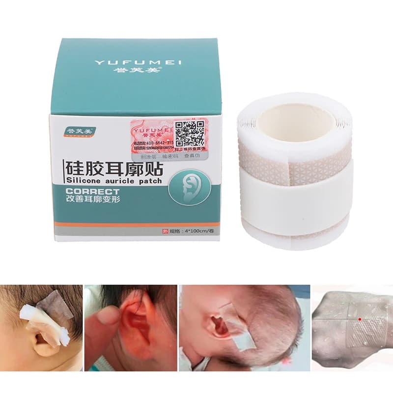 Silicone Tape Child Infant Baby Ear Correction Soft Silicone Tape (50 x 4cm) Personal Health Care Ear Care