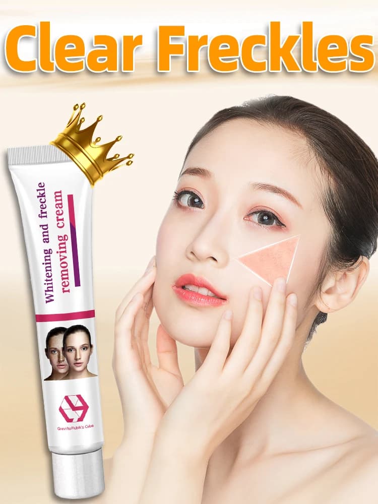 Freckles Dark Age Sun Spot Chloasma Diminish