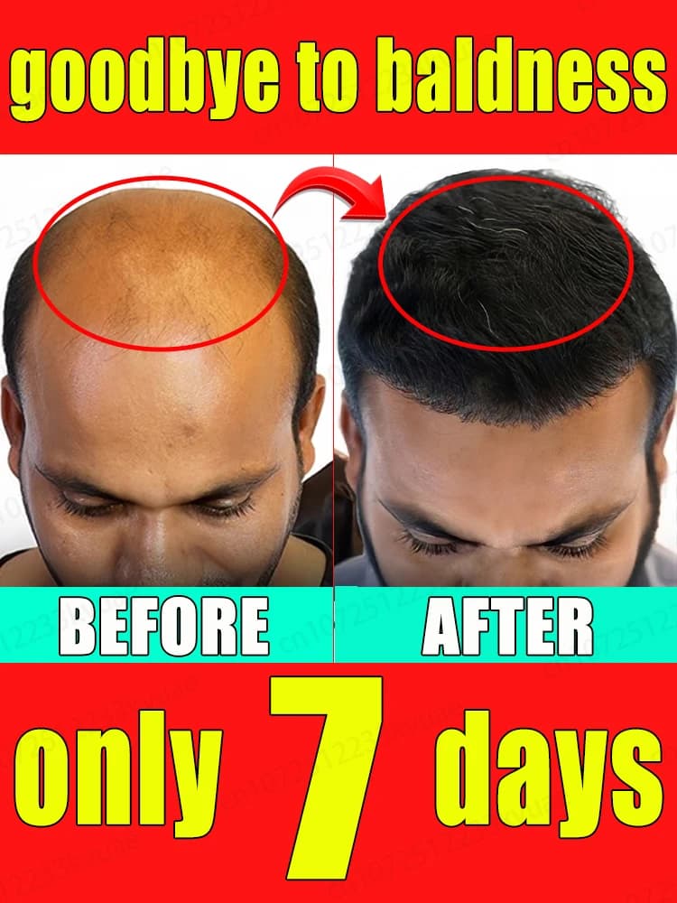 Hair Regrowth Products. Effectively repairs baldness and hair loss, suitable for all people