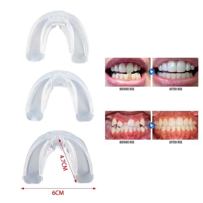 Tooth Dental Orthodontic Appliance Trainer Professional Alignment Straightening Brace Teeth Corrector Mouth Guard for Adult