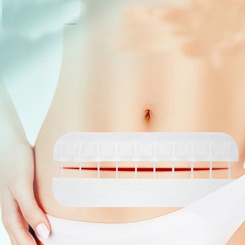 Zippered Wound Painless Suture Adhesive Wound Closure Band Aid Fast Suture Zipper Band-Aid Outdoor Portable Suture-free Band-Aid