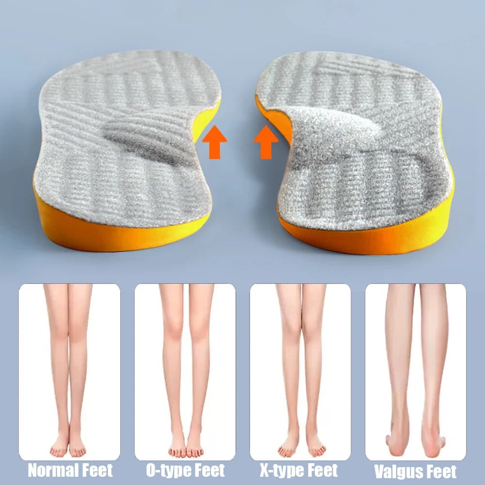 1Pair Arch Support Insole for Flat Feet O/X-Leg Orthopedic Insoles Plantar Fasciitis Shoe Pads Adults Kids Foot Care Shoe Sole