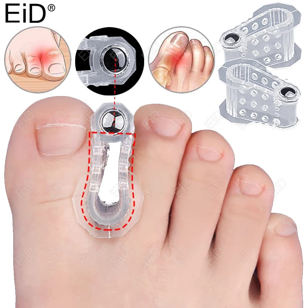 Magnet Orthopedic Foot Big Toe Straightener Hallux Valgus Bunion Corrector Orthotic Feet Bone Thumb Adjuster Correction Pedicure